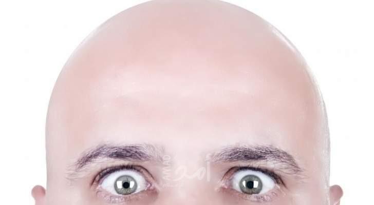 نصائح لعلاج الصلع وتساقط الشعر لدى الرجال
