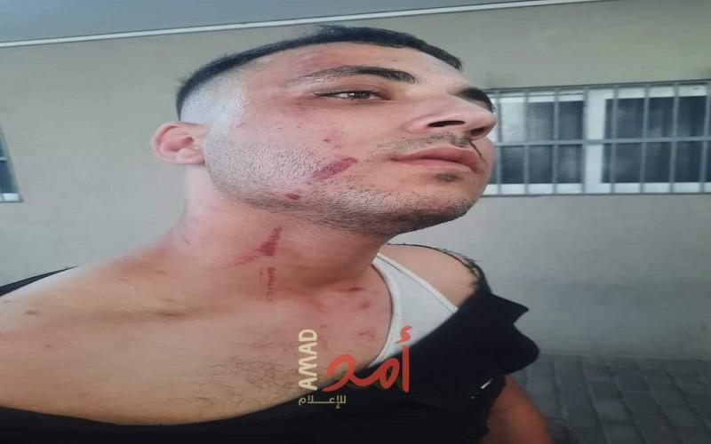شرطة مرورو حماس تعتدي على المواطن عبد الكريم عجور  - صور