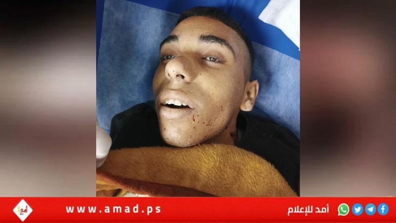 استشهاد الشاب "مصطفى قاسم" من مخيم جنين