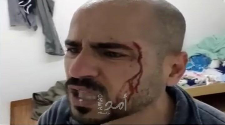 داخلية حماس توضح سبب ضرب الشاب في مركز الحجر الصحي شمال قطاع غزة