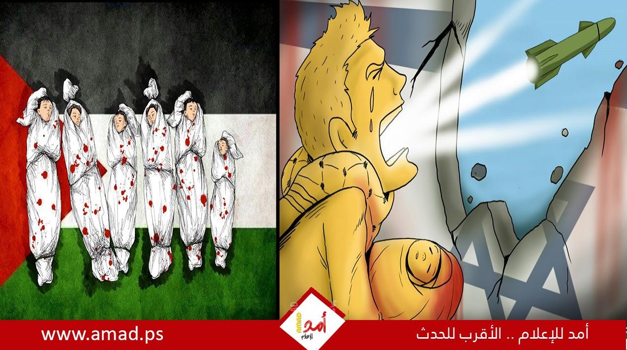 غزة: استشهاد الطفلة "حنين أبو قايدة" متأثرة بجراح خطيرة نتاج العدوان الإسرائيلي