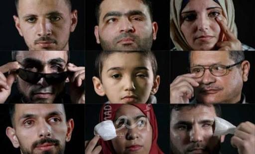 فلسطينيون فقدوا عينا خلال مواجهات يروون كيف انقلبت حياتهم