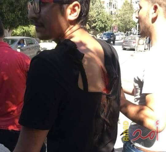نابلس: شجار بالآلات الحادة بين طلاب الشبيبة الفتحاوية والكتلة الإسلامية في جامعة النجاح