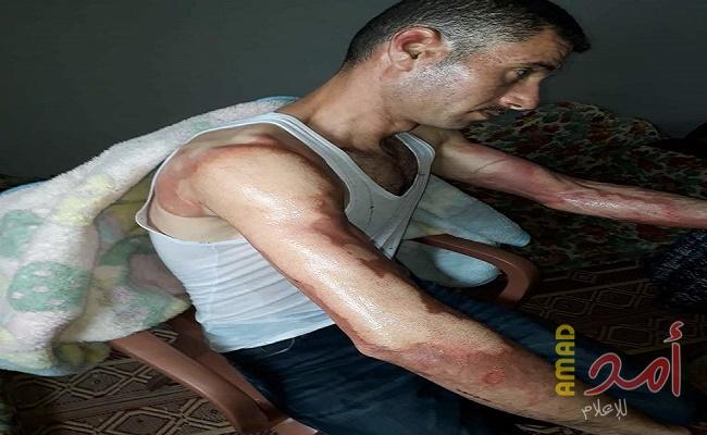 بالصور - نجاة أسرة المواطن أبو مشايخ  من الموت بأعجوبة