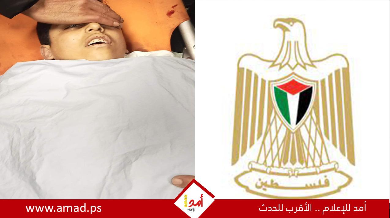الصحة الفلسطينية: استشهاد الطفل قصي واكد متأثراً بإصابته