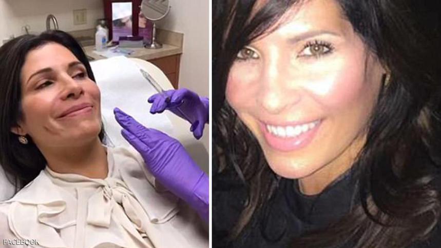 تجري 8 عمليات تجميلية من أجل " ميلانيا ترامب"