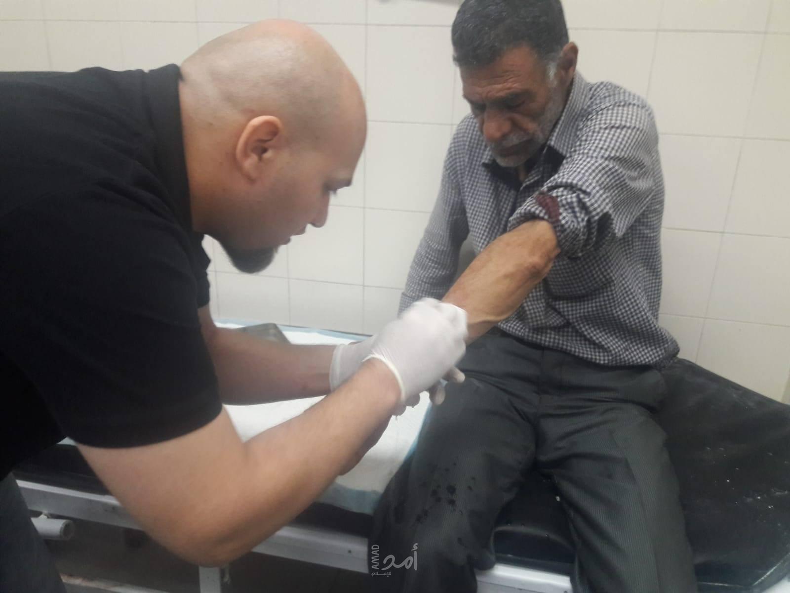 إصابة المواطن "ادريس زاهدة" بعد اعتداء المستوطنين عليه في الخليل