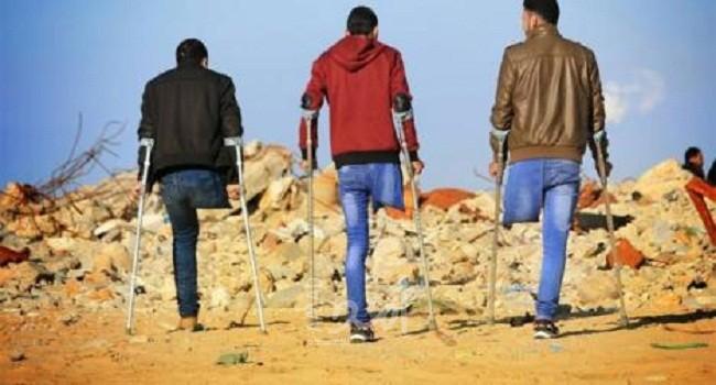 "أمد" يفتح ملف "مبتوري الأطراف".. معاناة وروايات تحكى لأول مرة! 