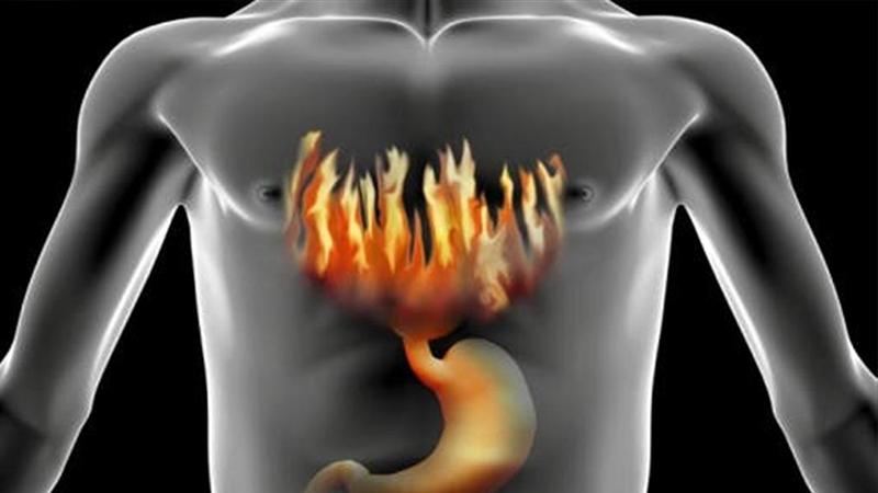 7 نصائح لعلاج الحموضة فى المنزل