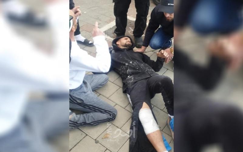 مستوطن يدهس مقدسيين بالقرب من "جورة العناب" في القدس المحتلة