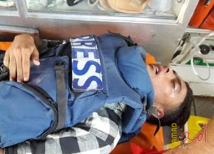 لجنة دعم الصحفيين: جيش الاحتلال يستهدف الأطراف السفلية للصحفيين ليعيق عملهم