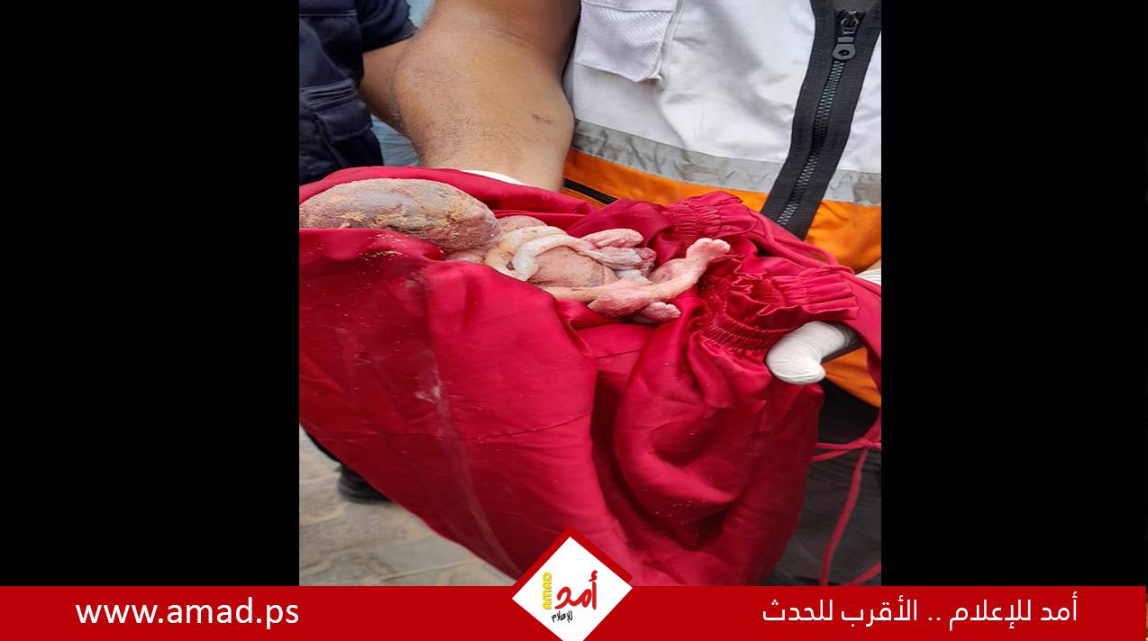 ولادة شهيدة لطفلها الشهيد في غزة.. حكاية تكرر مشهدها في العدوان الإسرائيلي على قطاع غزة - صور