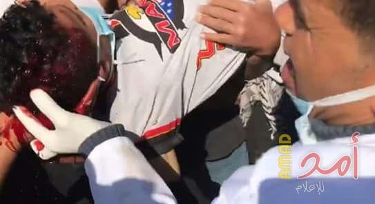 محدث.. بالفيديو والصور.. إصابة حرجة لـ "تحرير أبو سيلة" برصاصة في الرأس شرق خانيونس