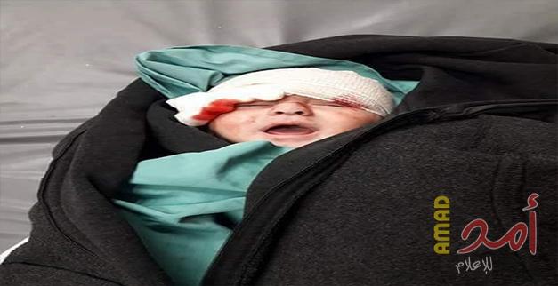 شهيدان وأكثر من 1100 مصاب حصيلة احداث "هبة القدس" في الضفة وغزة