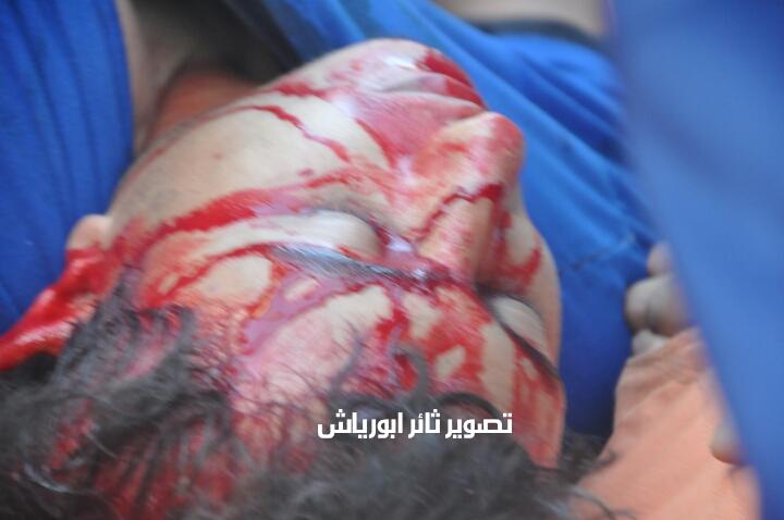 محدث.. 3 إصابات احداها خطيرة برصاص الاحتلال شرق جباليا بشمال قطاع غزة