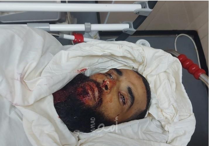 محدث.. استشهاد أحد موظفي بلدية البريج برصاص جيش الاحتلال وسط قطاع غزة