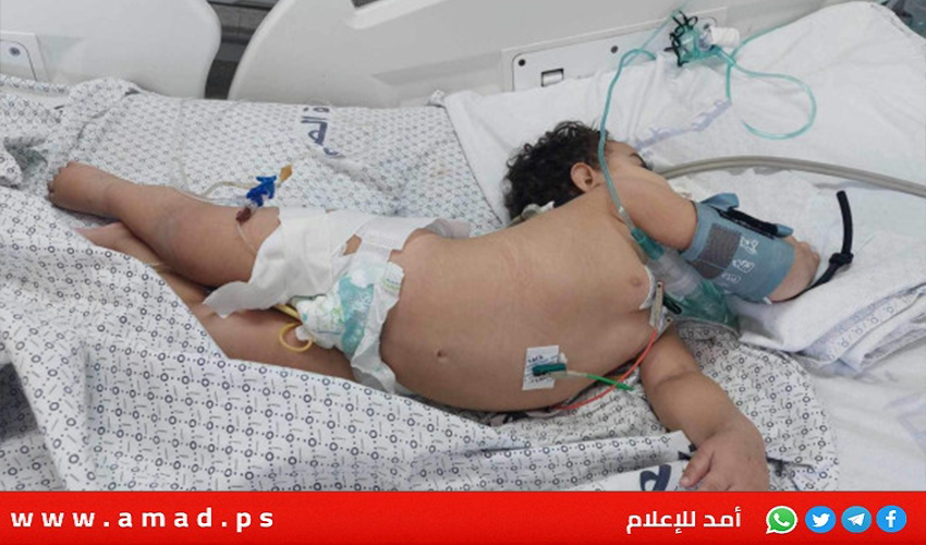 والد الطفلة لجين أبو دقة يناشد الرئيس عباس لتأمين علاجها