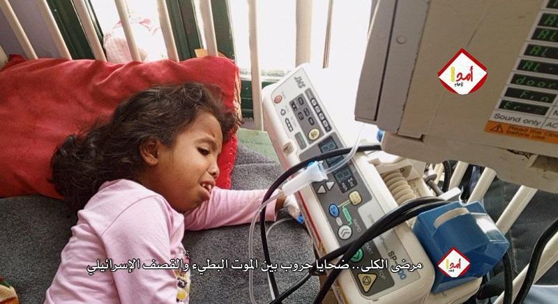 مرضى الكلى.. ضحايا حروب بين الموت البطيء والقتل الإسرائيلي