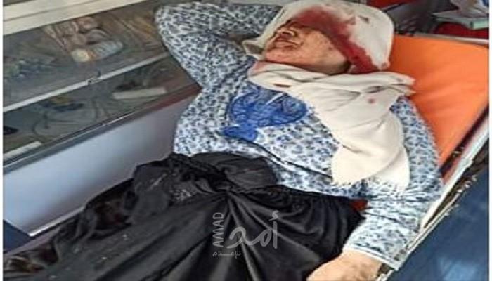 بعد ضرب الحجة صفية.. هبة الأسطل تطالب بالوقوف مع خالتها وانصافها