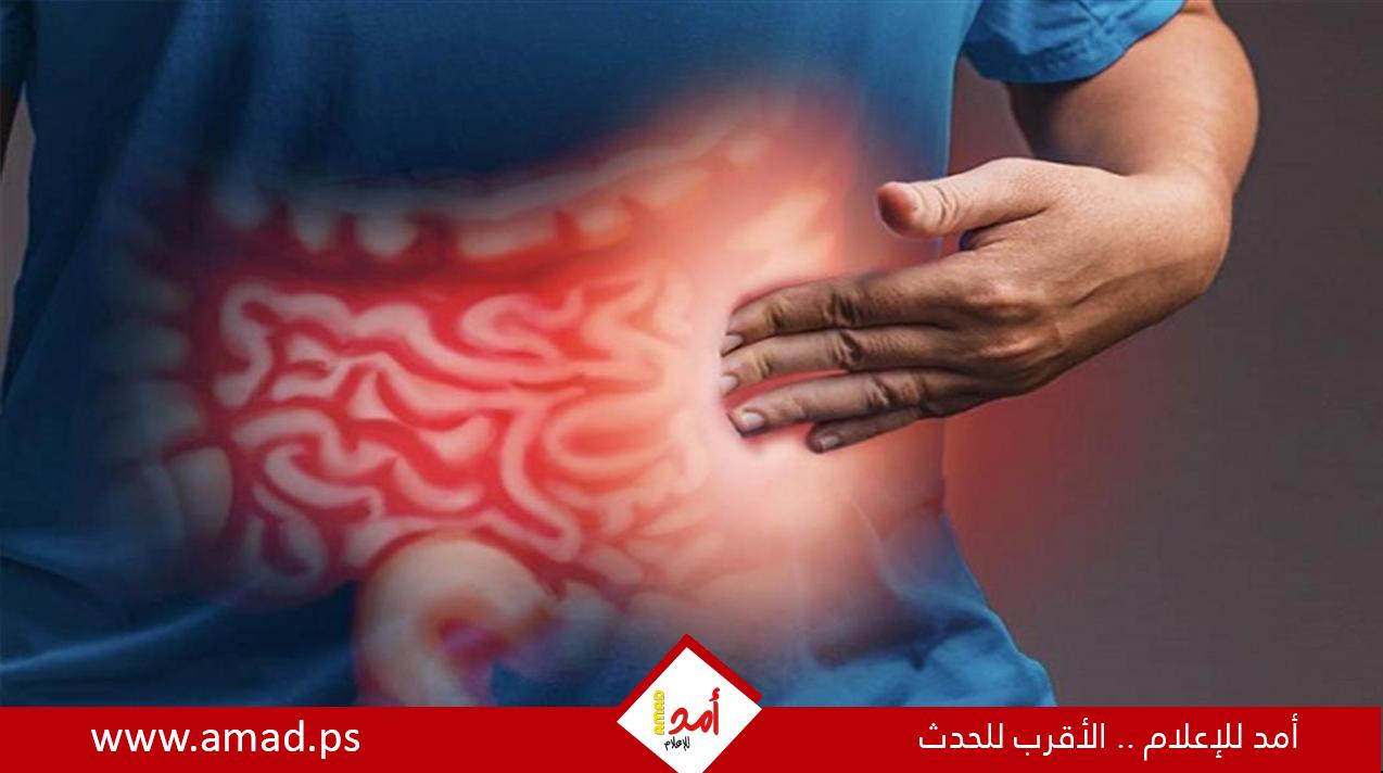 العلامات الصامتة لمرض "كرون"