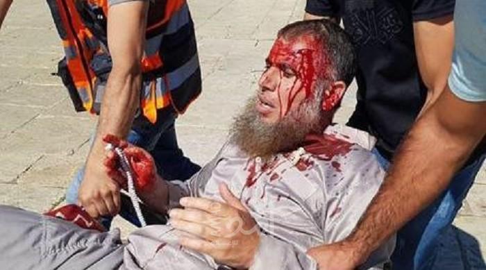 محدث .. الهلال الأحمر الفلسطيني: تعاملنا مع 61 مصاباً خلال اقتحام ساحات المسجد الأقصى