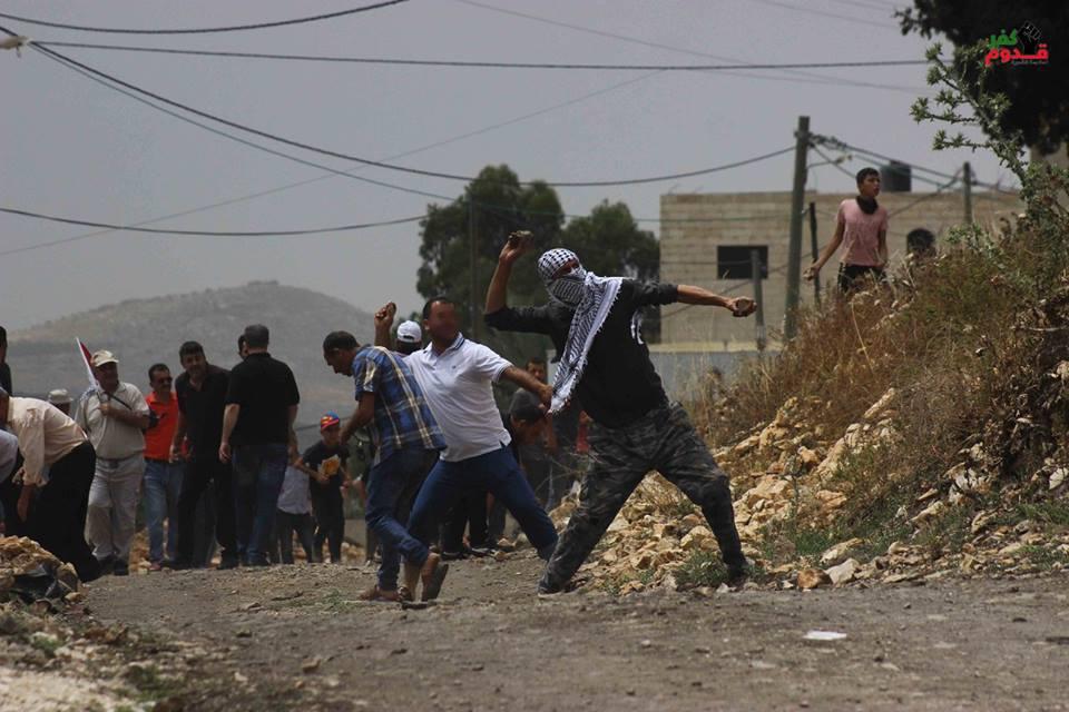 إصابة شاب برصاص الاحتلال في كفر قدوم