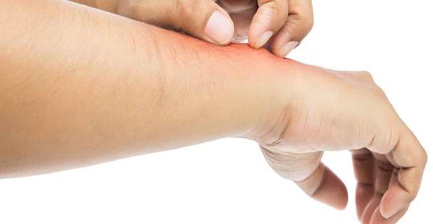 أسباب الطفح الجلدي وكيفية علاجه