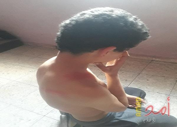 فيديو.. شهادات حية لطفل وممرضة لتعذيب أجهزة حماس واعتداءات زوار الفجر