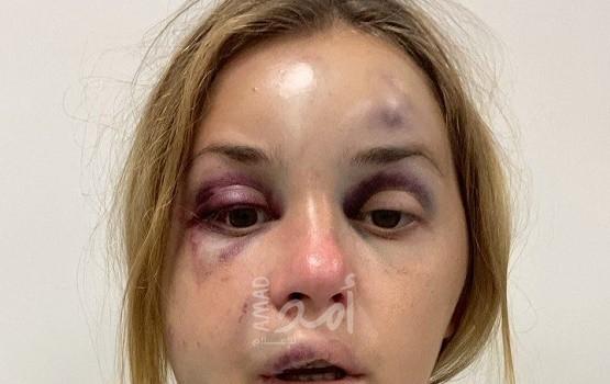 مذيعة تلفزيون أوكرانية تتعرض للضرب ومحاولة اغتصاب أمام ابنها