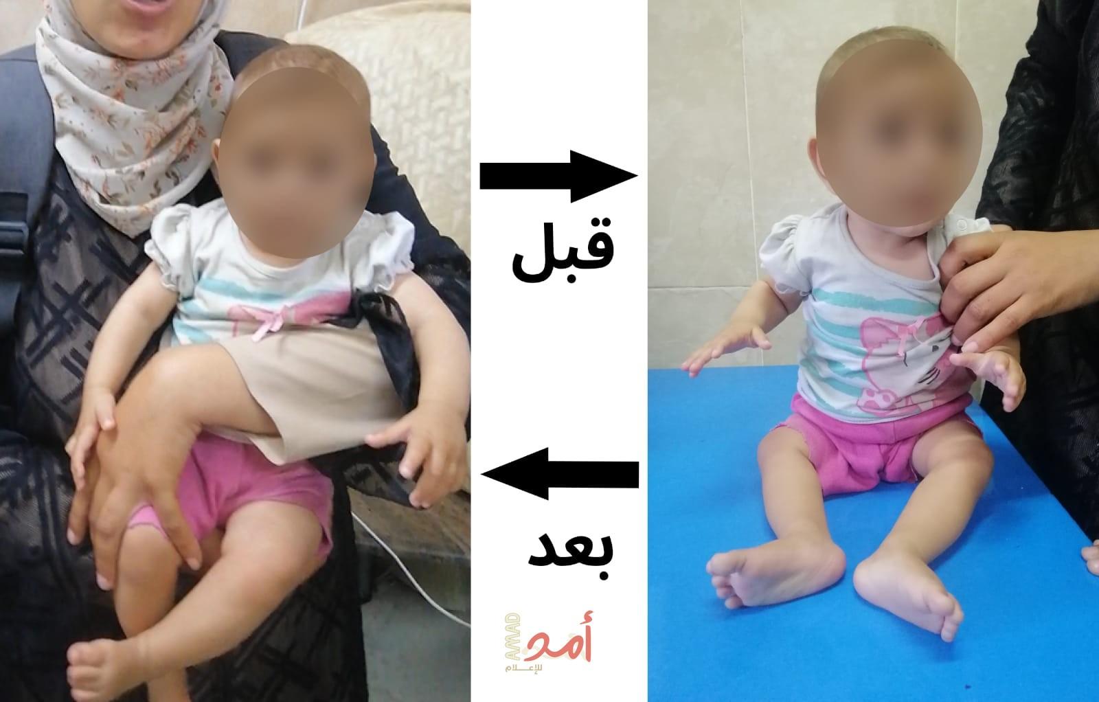 الهلال الأحمر الفلسطيني ينقذ: صور نجاحات في مكافحة سوء التغذية- صور