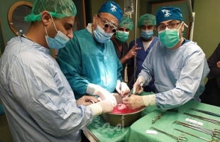 الصحة: المستشفيات الحكومية أجرت (136) عملية جراحية يومياً في الشهور الستة الأولى من 2021