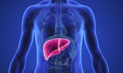 أعراض مرض الكبد الدهني