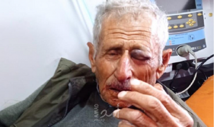 إصابة مسن بكسور ورضوض إثر اعتداء مستوطنين عليه شرق طولكرم - صورة