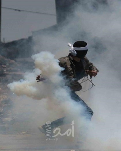 (8) إصابات برصاص قوات الاحتلال خلال قمع مسيرة كفر قدوم