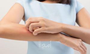 ظهور الكدمات على الجسم دون سبب واضح - تفاصيل